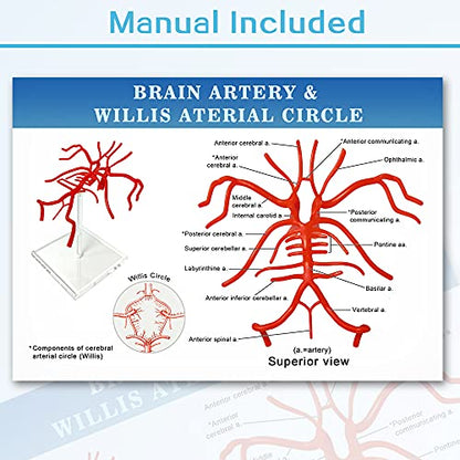 Brain Artery Model, Life Size Intracranial Artery Model On Plexiglass Base