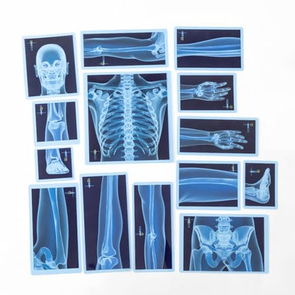 Ice Cream Counting Toy & Human Body X-Ray Set – Number Matching Cones and Anatomy Learning Cards for Kids STEM Education and Classroom Activities