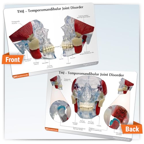 GPI Anatomicals Temporomandibular Joint (TMJ) Model with Pathologies