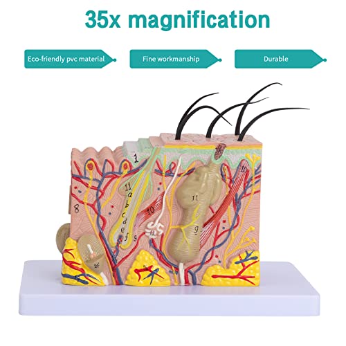 Skin Anatomical Model - Skin Layers Anatomy Model 35X Enlarged Anatomical Skin Model for Science Study or Patient Education - color: 35X