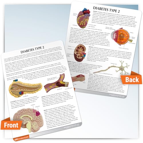 GPI Anatomicals Type II Diabetes Model Set - style: Type II Diabetes Model