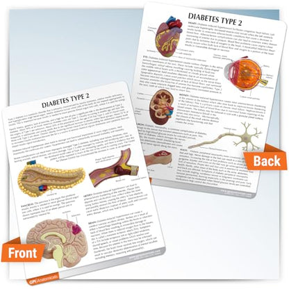 GPI Anatomicals Type II Diabetes Model Set - style: Type II Diabetes Model