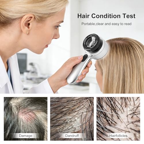 30x LED Dermatoscope Rechargeable Clarity 4 Modes Skin Scalp Hair