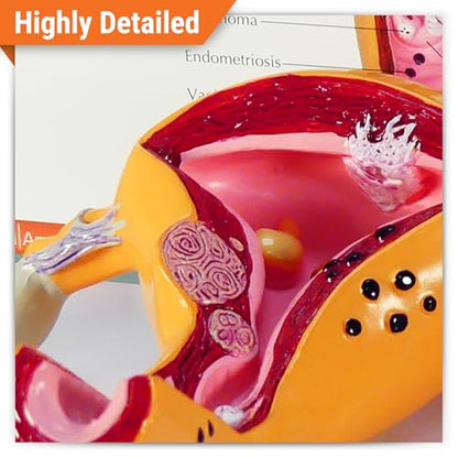 GPI Anatomicals Uterus and Ovary Model, Female Reproductive System - style: Uterus and ovary