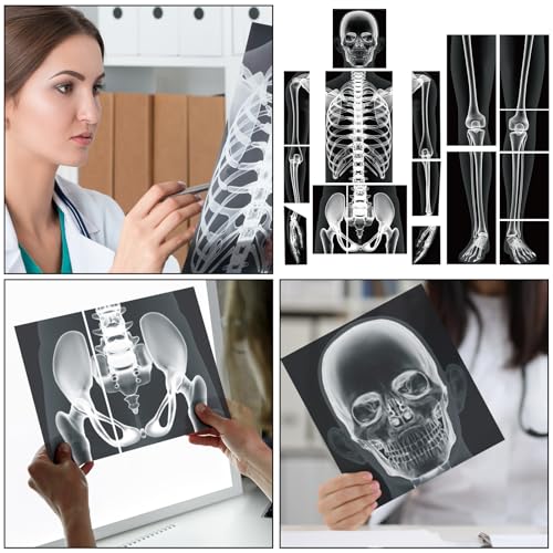 Lineshading 16 Pieces Human x Rays Bones Pretend x Rays for Kids Human Bones Body Educational Science Kit Display Play Table(Black and White) - color: Black and White