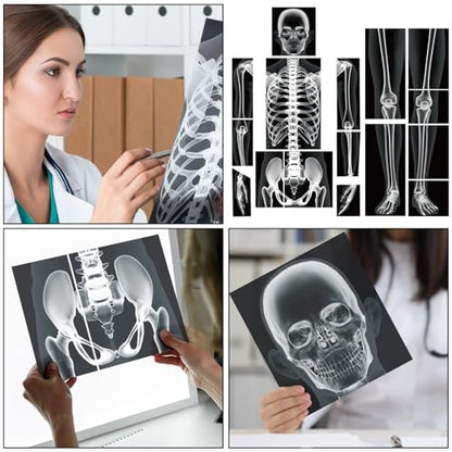 Lineshading 16 Pieces Human x Rays Bones Pretend x Rays for Kids Human Bones Body Educational Science Kit Display Play Table(Black and White) - color: Black and White