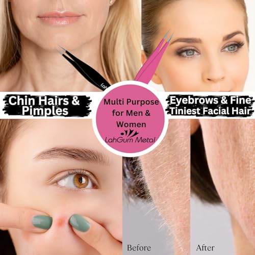 Ultra Fine Sharp Pointed Tweezers Precision, Needle Nose Pointy Tweezers for Ingrown Hair Removal Kit, Black & Pink, 2-Piece - color: Black & Pink, size: 2-Piece