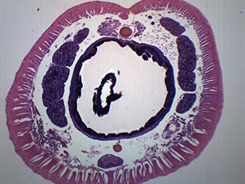 EISCO Earthworm Setae, Cross Section - Prepared Microscope Slide - 75 x 25mm - Biology & Microscopy - size: Single Slide