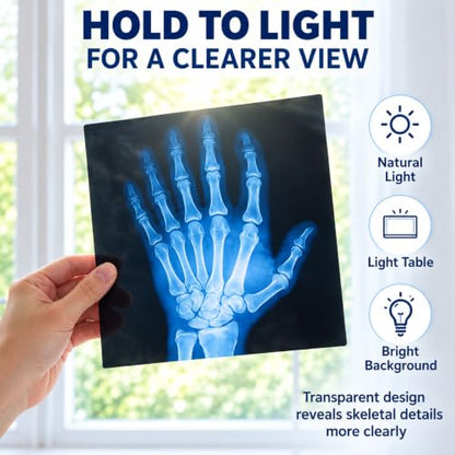 16 Pcs Broken Bones X-Ray Set Human Anatomy STEM Classroom Learning Films