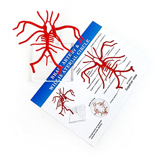 Brain Artery Model, Life Size Intracranial Artery Model On Plexiglass Base