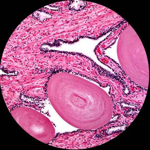 AmScope M500B-LED Cordless Monocular Compound Microscope, WF10x and WF20x