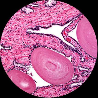 AmScope M500B-LED Cordless Monocular Compound Microscope, WF10x and WF20x