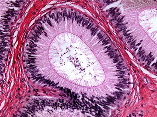 AmScope M500B-LED Cordless Monocular Compound Microscope, WF10x and WF20x